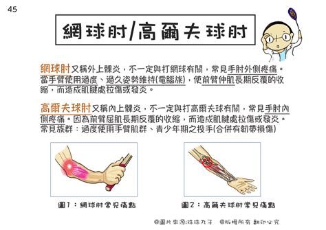 手受傷|手肘痛、手腕痛、手指痛的原因,治療與自我檢查 » 台。